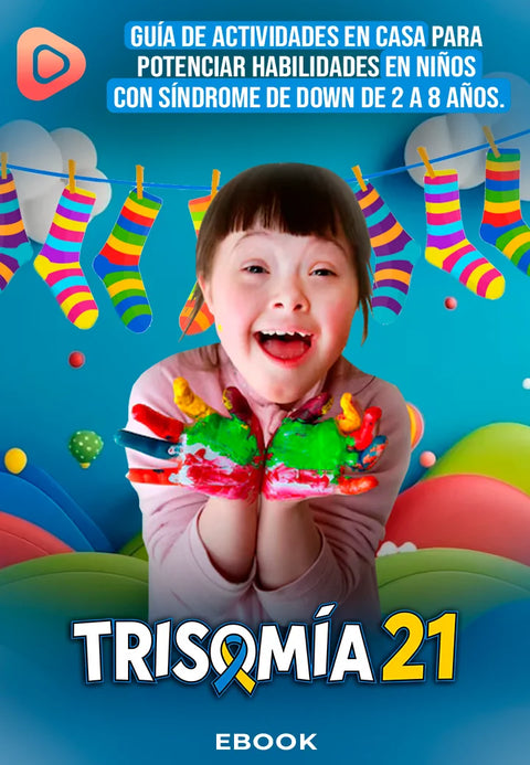 Trisomía 21